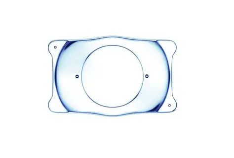 Vision Correction – ICL Lenses